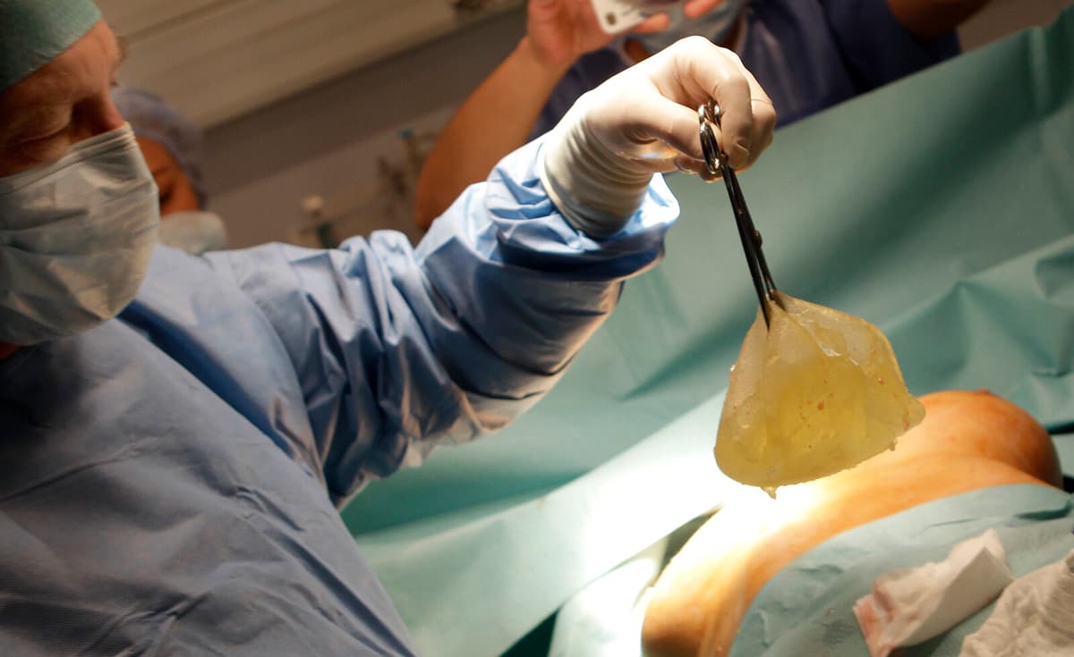 The new owner of Bilprovningen embroiled in breast implant scandal