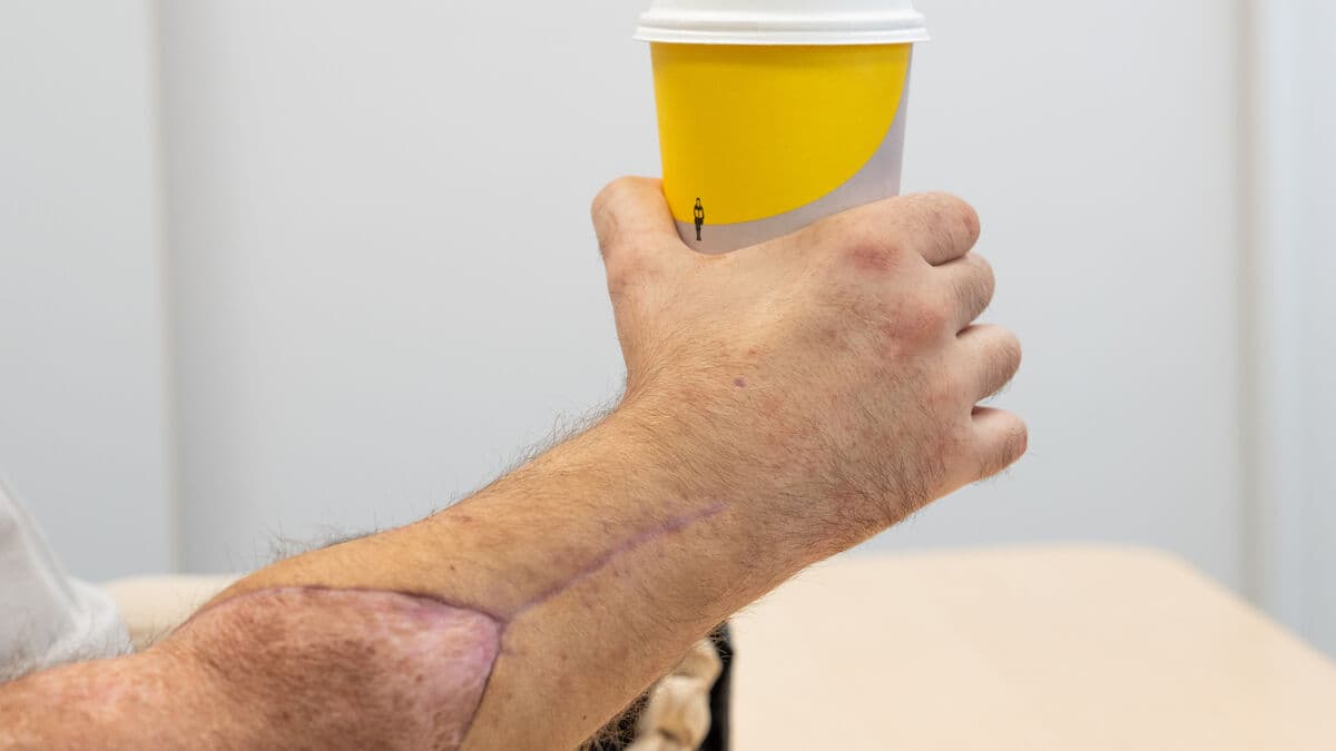 Got two new hands this summer – eats with cutlery