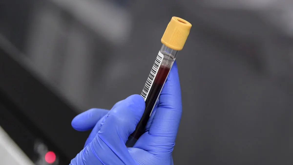 How to detect Parkinson's early with a blood test